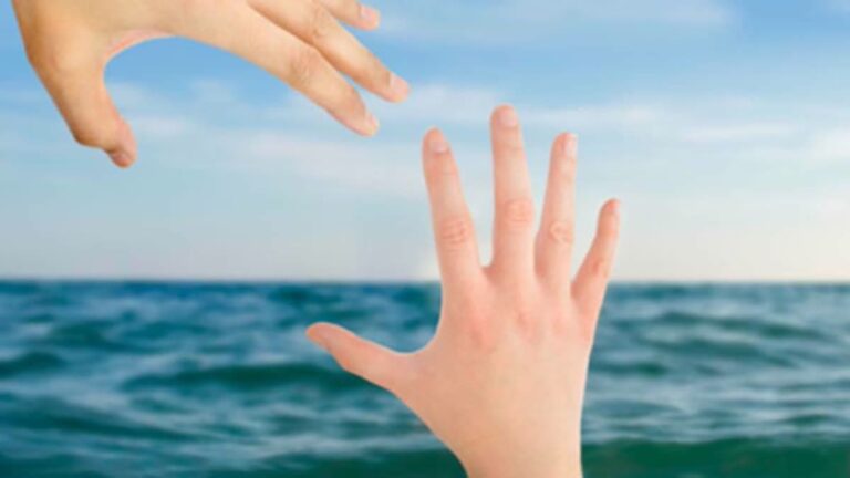 representation image