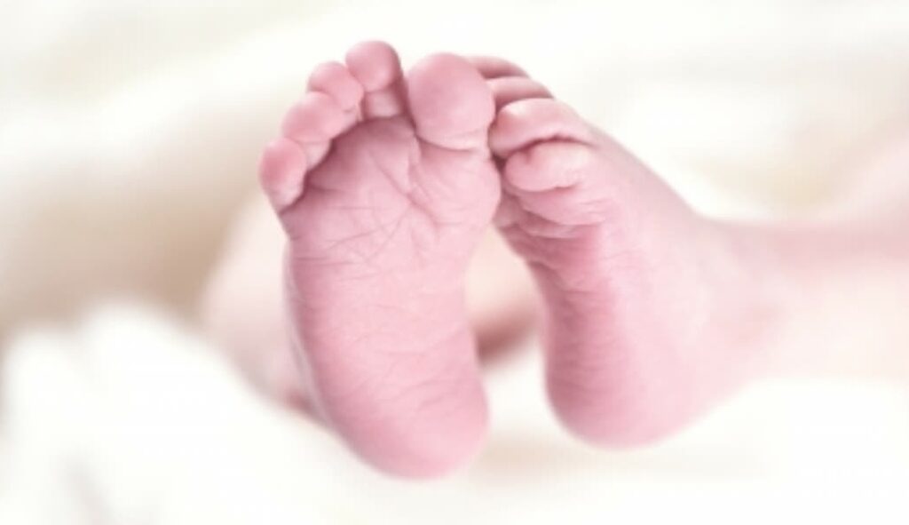 representation image